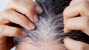 issue ablandador de canas 15ml. - Imagen 5